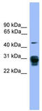 Proteasome 26S Subunit, Non-ATPase 9 antibody, TA342581, Origene, Western Blot image 