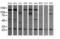 VPS28 Subunit Of ESCRT-I antibody, LS-C799443, Lifespan Biosciences, Western Blot image 