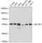 Transducin Beta Like 1 X-Linked Receptor 1 antibody, 23-975, ProSci, Western Blot image 