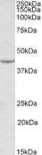 VEGF antibody, MBS423138, MyBioSource, Western Blot image 