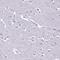 B Cell Scaffold Protein With Ankyrin Repeats 1 antibody, HPA037002, Atlas Antibodies, Immunohistochemistry paraffin image 