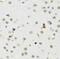 Histone-lysine N-methyltransferase SETDB1 antibody, FNab07771, FineTest, Immunohistochemistry paraffin image 
