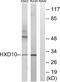 Homeobox D10 antibody, A30724, Boster Biological Technology, Western Blot image 
