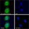 Ubiquitin Conjugating Enzyme E2 C antibody, GTX89866, GeneTex, Immunofluorescence image 