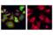 Tyrosine Hydroxylase antibody, 13106S, Cell Signaling Technology, Immunofluorescence image 