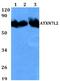 Ataxin 7 Like 2 antibody, PA5-75784, Invitrogen Antibodies, Western Blot image 