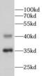 Nucleoporin 35 antibody, FNab05925, FineTest, Western Blot image 