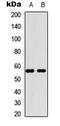 Membrane Bound Transcription Factor Peptidase, Site 2 antibody, LS-C356176, Lifespan Biosciences, Western Blot image 
