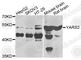 Tyrosyl-TRNA Synthetase 2 antibody, A7976, ABclonal Technology, Western Blot image 