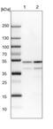 Protein Phosphatase 2 Regulatory Subunit Bbeta antibody, NBP2-46667, Novus Biologicals, Western Blot image 