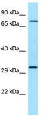 PTPRF Interacting Protein Alpha 4 antibody, TA331286, Origene, Western Blot image 