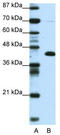 Zinc finger and BTB domain-containing protein 25 antibody, TA333901, Origene, Western Blot image 