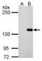 DNA (cytosine-5)-methyltransferase 3B antibody, NBP2-16206, Novus Biologicals, Western Blot image 