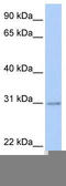 Homeobox C11 antibody, TA329716, Origene, Western Blot image 
