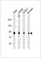 Phosphofructokinase, Platelet antibody, M07337, Boster Biological Technology, Western Blot image 