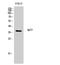 Immunoglobulin Heavy Constant Gamma 1 (G1m Marker) antibody, A04575, Boster Biological Technology, Western Blot image 