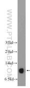 Small Nuclear Ribonucleoprotein Polypeptide E antibody, 20407-1-AP, Proteintech Group, Western Blot image 