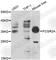 Fc Fragment Of IgG Receptor IIa antibody, A1388, ABclonal Technology, Western Blot image 