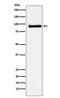 Zinc Finger And BTB Domain Containing 33 antibody, M04754, Boster Biological Technology, Western Blot image 