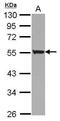 Keratin 72 antibody, PA5-30898, Invitrogen Antibodies, Western Blot image 