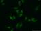 Valosin Containing Protein antibody, 10736-1-AP, Proteintech Group, Immunofluorescence image 