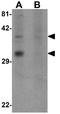 2-Oxoglutarate And Iron Dependent Oxygenase Domain Containing 2 antibody, GTX32004, GeneTex, Western Blot image 
