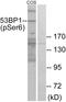 Tumor Protein P53 Binding Protein 1 antibody, LS-C291157, Lifespan Biosciences, Western Blot image 
