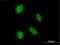 ASXL Transcriptional Regulator 2 antibody, H00055252-B01P, Novus Biologicals, Immunocytochemistry image 