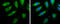 Pyruvate Dehydrogenase E1 Alpha 1 Subunit antibody, GTX104015, GeneTex, Immunocytochemistry image 