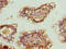 Zinc Finger Protein 281 antibody, A63844-100, Epigentek, Immunohistochemistry paraffin image 