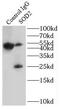 Superoxide Dismutase 2 antibody, FNab08104, FineTest, Immunoprecipitation image 