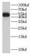 Ligand Dependent Nuclear Receptor Corepressor antibody, FNab04730, FineTest, Western Blot image 