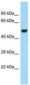 Legumain antibody, TA331335, Origene, Western Blot image 