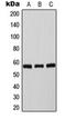 Tyrosine Hydroxylase antibody, orb224024, Biorbyt, Western Blot image 