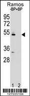 Zinc Finger DHHC-Type Containing 2 antibody, 61-982, ProSci, Western Blot image 