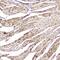 Fatty Acid Binding Protein 3 antibody, A01734-1, Boster Biological Technology, Immunohistochemistry paraffin image 