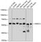 Pre-MRNA Processing Factor 31 antibody, GTX33433, GeneTex, Western Blot image 