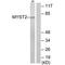 Lysine Acetyltransferase 7 antibody, PA5-49777, Invitrogen Antibodies, Western Blot image 