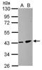 Zinc Finger DHHC-Type Containing 11 antibody, NBP2-15166, Novus Biologicals, Western Blot image 