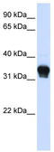 Casein Kinase 1 Alpha 1 antibody, TA339970, Origene, Western Blot image 