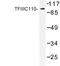 General Transcription Factor IIIC Subunit 2 antibody, LS-C176825, Lifespan Biosciences, Western Blot image 