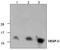 Vascular Endothelial Growth Factor C antibody, TA319108, Origene, Western Blot image 
