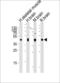 Prolyl 4-Hydroxylase Subunit Alpha 1 antibody, orb331162, Biorbyt, Western Blot image 