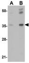 Rhomboid domain-containing protein 2 antibody, GTX85219, GeneTex, Western Blot image 