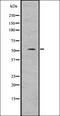 SUFU Negative Regulator Of Hedgehog Signaling antibody, orb336747, Biorbyt, Western Blot image 