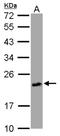 Uracil Phosphoribosyltransferase Homolog antibody, NBP2-16547, Novus Biologicals, Western Blot image 