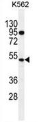 DNA nucleotidylexotransferase antibody, AP54213PU-N, Origene, Western Blot image 