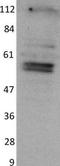 NIMA Related Kinase 2 antibody, H00004751-M02, Novus Biologicals, Western Blot image 