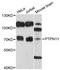 Protein Tyrosine Phosphatase Non-Receptor Type 11 antibody, orb136202, Biorbyt, Western Blot image 