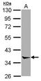 Annexin A8 antibody, GTX119470, GeneTex, Western Blot image 